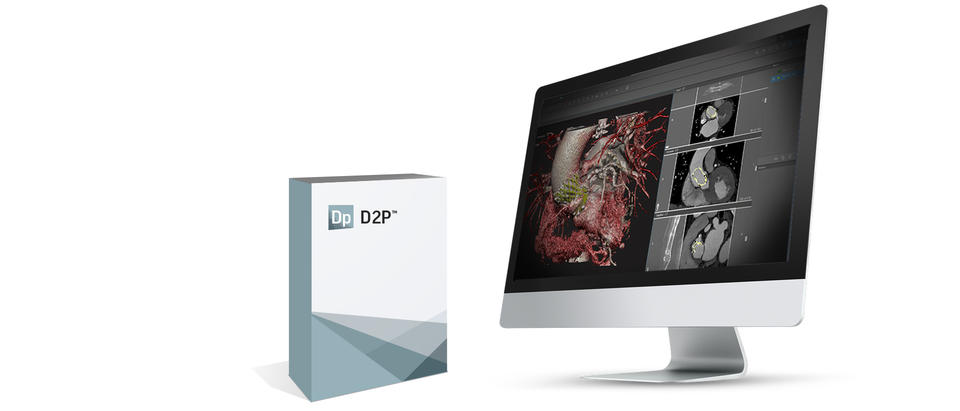 医療用画像を、シンプルにパワフルに3Dデータへ変換