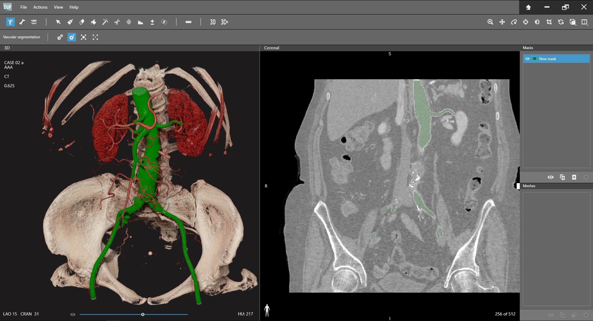 D2p Dicom To Print｜製品詳細｜医療ct Mri用dicom 3dコンバーター D2p