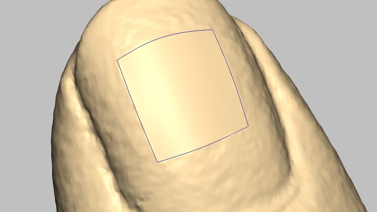 スムージングの種類