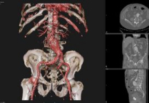 D2P/DICOM to PRINT