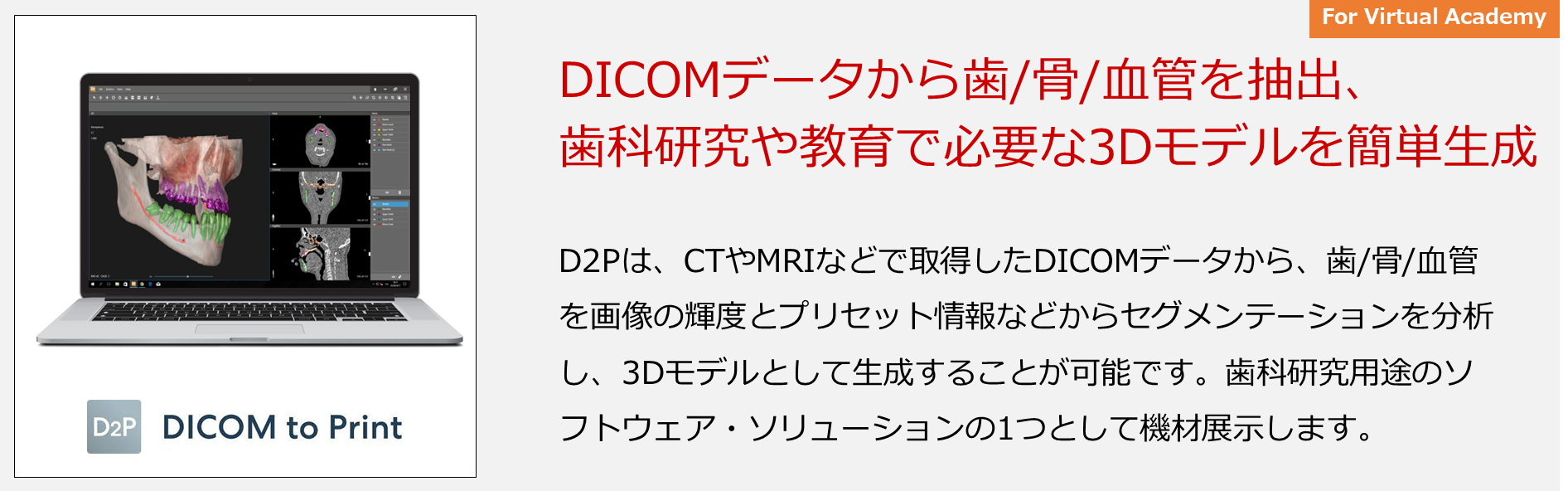 D2Pは、CTやMRIなどで取得したDICOMデータから、歯/骨/血管を画像の輝度とプリセット情報などからセグメンテーションを分析し、3Dモデルとして生成することが可能です。歯科研究用途のソフトウェア・ソリューションの1つとして機材展示します。