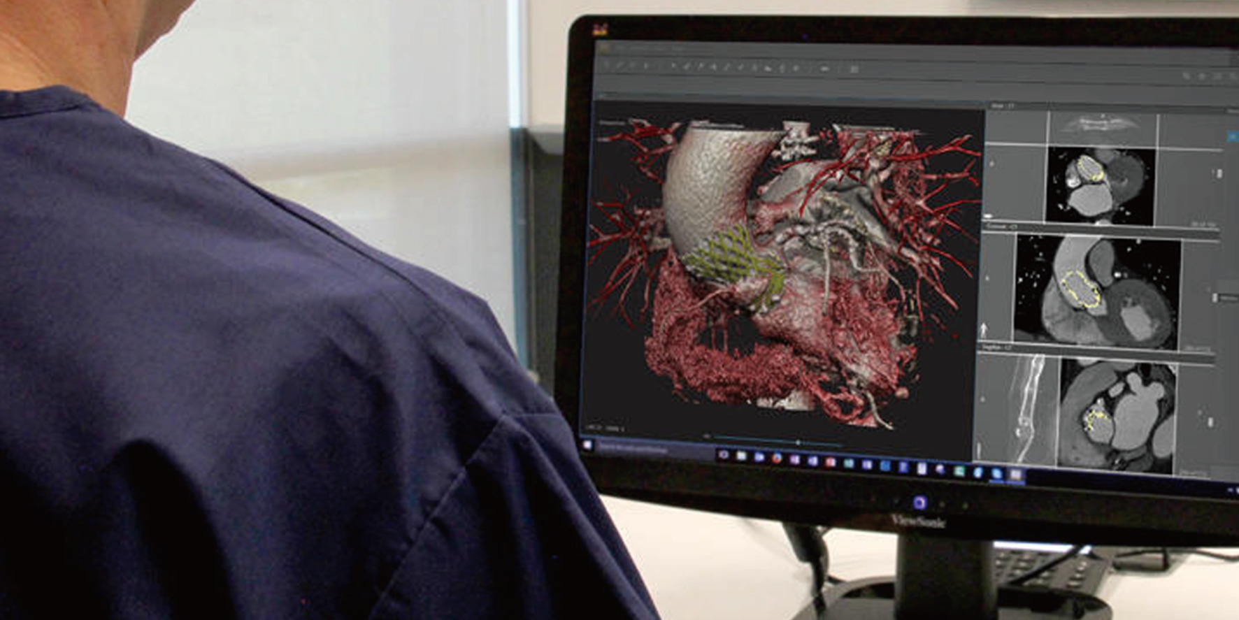 DICOM画像から3Dモデルを生成し、医療現場での
診断・解析を支援する高精度な可視化・計測ツール