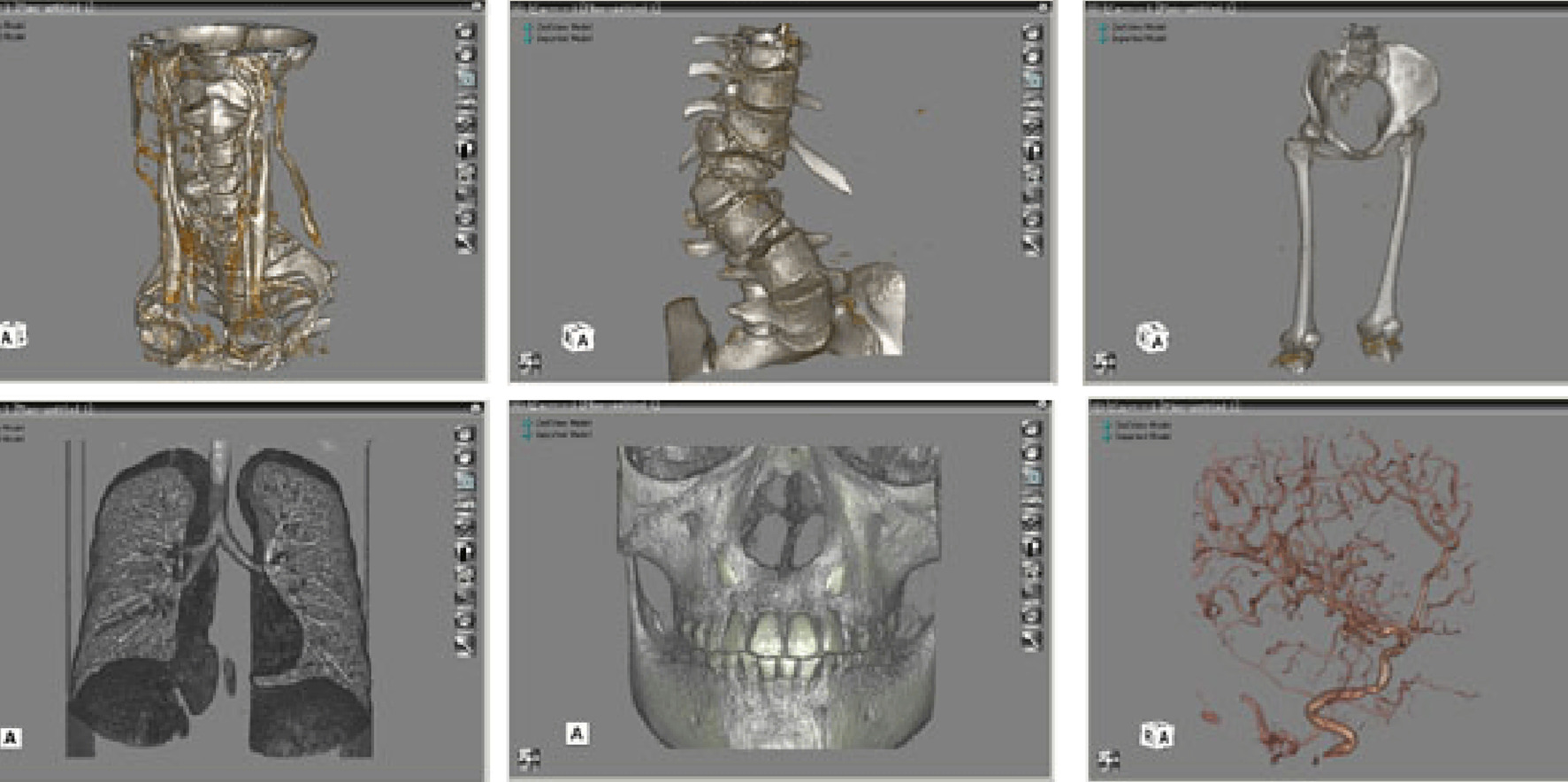多様な画像形式に対応した3D可視化・解析